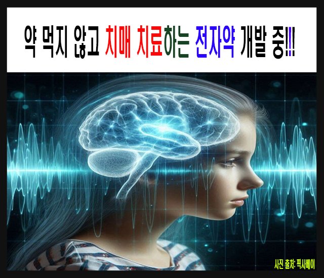 [초고령사회 #13] 약 먹지 않고 치매 치료하는 전자약 개발 중-1.jpg
